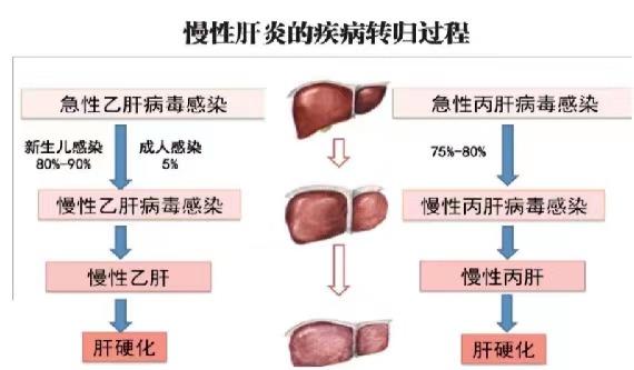 【健康科普】世界肝炎日——堅持早預防，加強檢測發(fā)現(xiàn)，規(guī)范抗病毒治療